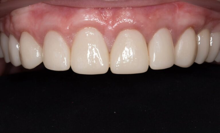 Cerec3